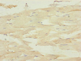 Dynactin 3 / DCTN3 Antibody - Immunohistochemistry of paraffin-embedded human skeletal muscle tissue at dilution of 1:100