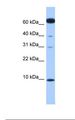 DYNLL1 / PIN Antibody - Fetal heart lysate. Antibody concentration: 1.0 ug/ml. Gel concentration: 10-20%.  This image was taken for the unconjugated form of this product. Other forms have not been tested.
