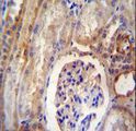 DYNLRB2 Antibody - DYNLRB2 antibody immunohistochemistry of formalin-fixed and paraffin-embedded human kidney tissue followed by peroxidase-conjugated secondary antibody and DAB staining.