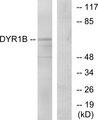 DYRK1B Antibody - Western blot analysis of extracts from Jurkat cells, using DYR1B antibody.