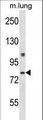 DYRK4 Antibody - Mouse Dyrk4 Antibody western blot of mouse lung tissue lysates (35 ug/lane). The Dyrk4 antibody detected the Dyrk4 protein (arrow).