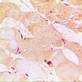 Dysferlin Antibody - Immunohistochemical analysis of Dysferlin staining in human muscle formalin fixed paraffin embedded tissue section. The section was pre-treated using heat mediated antigen retrieval with sodium citrate buffer (pH 6.0). The section was then incubated with the antibody at room temperature and detected using an HRP conjugated compact polymer system. DAB was used as the chromogen. The section was then counterstained with hematoxylin and mounted with DPX.