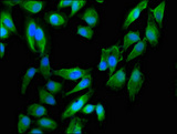 Dystonin / BPAG1 Antibody - Immunofluorescent analysis of Hela cells using DST Antibody at dilution of 1:100 and Alexa Fluor 488-congugated AffiniPure Goat Anti-Rabbit IgG(H+L)