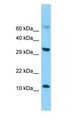 E-FABP / FABP5 Antibody - E-FABP / FABP5 antibody Western Blot of Mouse Thymus.  This image was taken for the unconjugated form of this product. Other forms have not been tested.