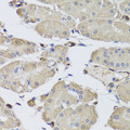 E-FABP / FABP5 Antibody - Immunohistochemistry of paraffin-embedded human stomach using FABP5 antibodyat dilution of 1:100 (40x lens).