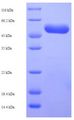 CFA/I Fimbrial Subunit E Protein