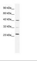 E2F1 Antibody - Daudi Cell Lysate.  This image was taken for the unconjugated form of this product. Other forms have not been tested.