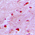 E2F2 Antibody - Immunohistochemical analysis of E2F2 staining in human brain formalin fixed paraffin embedded tissue section. The section was pre-treated using heat mediated antigen retrieval with sodium citrate buffer (pH 6.0). The section was then incubated with the antibody at room temperature and detected using an HRP conjugated compact polymer system. DAB was used as the chromogen. The section was then counterstained with hematoxylin and mounted with DPX.
