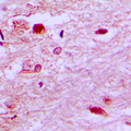 E2F6 Antibody - Immunohistochemical analysis of E2F6 staining in human brain formalin fixed paraffin embedded tissue section. The section was pre-treated using heat mediated antigen retrieval with sodium citrate buffer (pH 6.0). The section was then incubated with the antibody at room temperature and detected using an HRP conjugated compact polymer system. DAB was used as the chromogen. The section was then counterstained with hematoxylin and mounted with DPX.