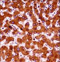 E4 / UBE4A Antibody - UBE4A Antibody immunohistochemistry of formalin-fixed and paraffin-embedded human liver tissue followed by peroxidase-conjugated secondary antibody and DAB staining.
