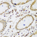 E6AP / UBE3A Antibody - Immunohistochemistry of paraffin-embedded human gastric using UBE3A antibodyat dilution of 1:200 (40x lens).