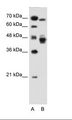 EAR2 / NR2F6 Antibody - A: Marker, HepG2 Cell Lysate.  This image was taken for the unconjugated form of this product. Other forms have not been tested.