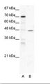 EAR2 / NR2F6 Antibody - A: Marker, B: HepG2 Cell Lysate.  This image was taken for the unconjugated form of this product. Other forms have not been tested.