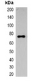 ECFP Tag Antibody - Western blot analysis of over-expressed ECFP-tagged protein in 293T cell lysate.