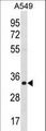 ECH1 Antibody - ECH1 Antibody western blot of A549 cell line lysates (35 ug/lane). The ECH1 antibody detected the ECH1 protein (arrow).