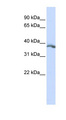 EDA / Ectodysplasin A Antibody - EDA antibody Western blot of HepG2 cell lysate. This image was taken for the unconjugated form of this product. Other forms have not been tested.
