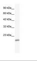 EDF1 / MBF1 Antibody - Jurkat Cell Lysate.  This image was taken for the unconjugated form of this product. Other forms have not been tested.