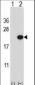EDN2 / Endothelin 2 Antibody - Western blot of EDN2 (arrow) using rabbit polyclonal EDN2 Antibody. 293 cell lysates (2 ug/lane) either nontransfected (Lane 1) or transiently transfected (Lane 2) with the EDN2 gene.