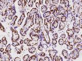EDR / PEG10 Antibody - Immunochemical staining of human PEG10 in human placenta with rabbit polyclonal antibody at 1:1000 dilution, formalin-fixed paraffin embedded sections.