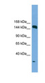 EEA1 Antibody - EEA1 antibody Western blot of HepG2 cell lysate. This image was taken for the unconjugated form of this product. Other forms have not been tested.