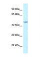 EED Antibody - EED antibody Western blot of Rat Muscle lysate. Antibody concentration 1 ug/ml.  This image was taken for the unconjugated form of this product. Other forms have not been tested.