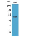 EEF1A1 + EEF1A2 Antibody - Western blot of Acetyl-EF-1 alpha1/2 (K41) antibody