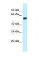 EEPD1 Antibody - Eepd1 antibody Western blot of Small Intestine lysate. Antibody concentration 1 ug/ml.  This image was taken for the unconjugated form of this product. Other forms have not been tested.