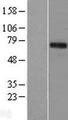EEYORE / TIGD1 Protein - Western validation with an anti-DDK antibody * L: Control HEK293 lysate R: Over-expression lysate