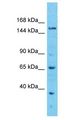 EFCAB5 Antibody - EFCAB5 antibody Western Blot of ACHN. Antibody dilution: 1 ug/ml.  This image was taken for the unconjugated form of this product. Other forms have not been tested.