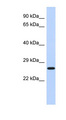EFHD2 Antibody - EFHD2 antibody Western blot of Fetal Lung lysate. This image was taken for the unconjugated form of this product. Other forms have not been tested.
