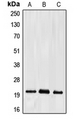 EFNA2 / Ephrin A2 Antibody - Western blot analysis of Ephrin A2 expression in HepG2 (A); mouse liver (B); rat kidney (C) whole cell lysates.