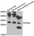 EFNA3 / Ephrin A3 Antibody - Western blot analysis of extract of various cells.