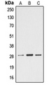 EFNA4 / Ephrin A4 Antibody - Western blot analysis of Ephrin A4 expression in Jurkat (A); mouse heart (B); rat heart (C) whole cell lysates.