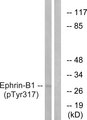 EFNB1 / Ephrin B1 Antibody - Western blot analysis of lysates from mouse brain, using EFNB1 (Phospho-Tyr317) Antibody. The lane on the right is blocked with the phospho peptide.