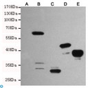 EGFP Antibody - Western blot detection of EGFP/EYFP expression in CHO-K1 transfected by different EGFP-fusion proteins (MW:B. 56kDa, C. 30kDa, D. 42kDa, E. 39kDa) or non-transfected (A) cell lysates using EGFP/EYFP mouse mAb (1:2500 diluted).