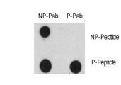 EGFR Antibody - Dot blot of Phospho-EGFR-Y1125 Antibody and EGFR Non Phospho-specific antibody on nitrocellulose membrane. 50ng of Phospho-peptide or Non Phospho-peptide per dot were adsorbed. Antibody working concentrations are 0.5ug per ml.