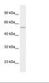 EGLN1 / PHD2 Antibody - HepG2 Cell Lysate.  This image was taken for the unconjugated form of this product. Other forms have not been tested.