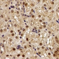 EGLN1 / PHD2 Antibody - Immunohistochemical analysis of EGLN1 staining in human kidney formalin fixed paraffin embedded tissue section. The section was pre-treated using heat mediated antigen retrieval with sodium citrate buffer (pH 6.0). The section was then incubated with the antibody at room temperature and detected using an HRP conjugated compact polymer system. DAB was used as the chromogen. The section was then counterstained with hematoxylin and mounted with DPX.