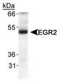 EGR2 Antibody - Detection of ERG2 in human fetal lung extracts using antibody.  This image was taken for the unconjugated form of this product. Other forms have not been tested.