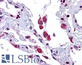 EIF2AK1 Antibody - Anti-EIF2AK1 antibody IHC of human lung. Immunohistochemistry of formalin-fixed, paraffin-embedded tissue after heat-induced antigen retrieval. Antibody concentration 5 ug/ml.  This image was taken for the unconjugated form of this product. Other forms have not been tested.