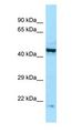 EIF2B2 Antibody - EIF2B2 / EIF2B antibody Western Blot of RPMI-8226.  This image was taken for the unconjugated form of this product. Other forms have not been tested.