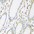 EIF2B2 Antibody - Immunohistochemistry of paraffin-embedded human stomach tissue.