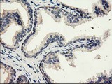 EIF2B3 Antibody - IHC of paraffin-embedded Human prostate tissue using anti-EIF2B3 mouse monoclonal antibody. (Heat-induced epitope retrieval by 10mM citric buffer, pH6.0, 100C for 10min).