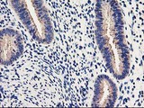 EIF2B3 Antibody - IHC of paraffin-embedded Human endometrium tissue using anti-EIF2B3 mouse monoclonal antibody. (Heat-induced epitope retrieval by 10mM citric buffer, pH6.0, 100C for 10min).