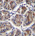 EIF3A Antibody - EIF3A Antibody immunohistochemistry of formalin-fixed and paraffin-embedded human stomach tissue followed by peroxidase-conjugated secondary antibody and DAB staining.