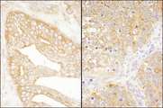 EIF3J Antibody - Detection of Human and Mouse eIF3J/EIF3S1 by Immunohistochemistry. Sample: FFPE section of human prostate carcinoma (left) and mouse teratoma (right). Antibody: Affinity purified rabbit anti-eIF3J/EIF3S1 used at a dilution of 1:1000 (1 Detection: DAB.