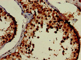 EIF3M / PCID1 Antibody - Immunohistochemistry of paraffin-embedded human testis tissue at dilution of 1:100