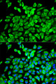 EIF4A1 Antibody - Immunofluorescence analysis of MCF-7 cells.