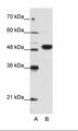 EIF4A2 Antibody - A: Marker, B: Jurkat Cell Lysate.  This image was taken for the unconjugated form of this product. Other forms have not been tested.
