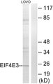 EIF4E3 Antibody - Western blot analysis of lysates from LOVO cells, using EIF4E3 Antibody. The lane on the right is blocked with the synthesized peptide.